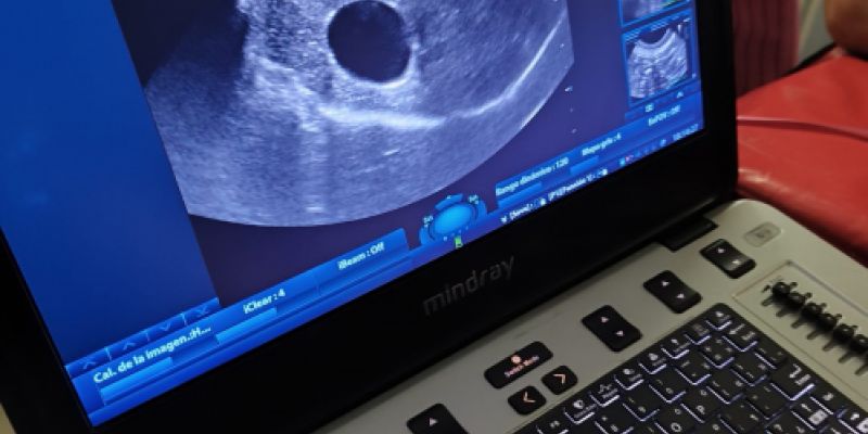 Ordenador para las ecografías Ordenador para las ecografías
